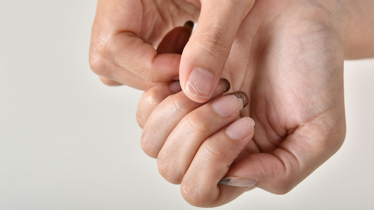 Nail Infection Treatment in Houston